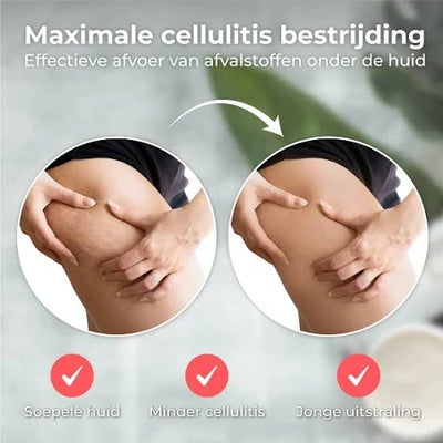 Elektrischer Cupper - Cellulite-Massagegerät 